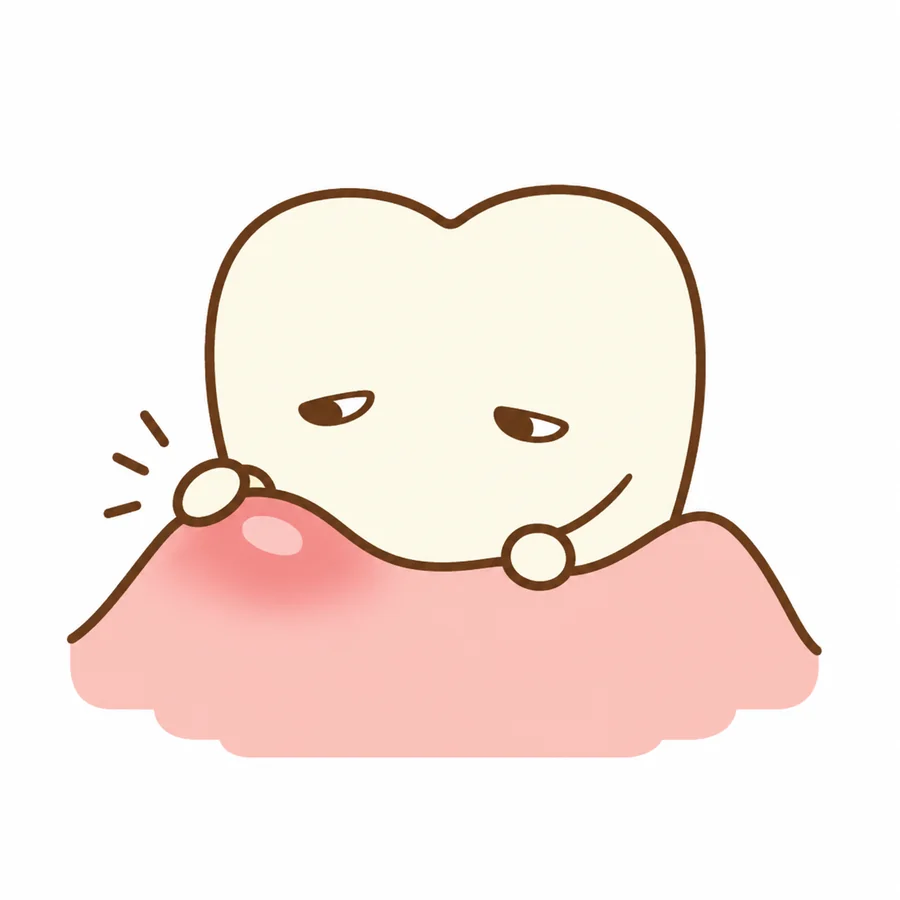 歯周病の治療を案内する歯のキャラクター